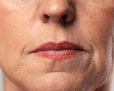 Close-up of a mouth before denture treatment