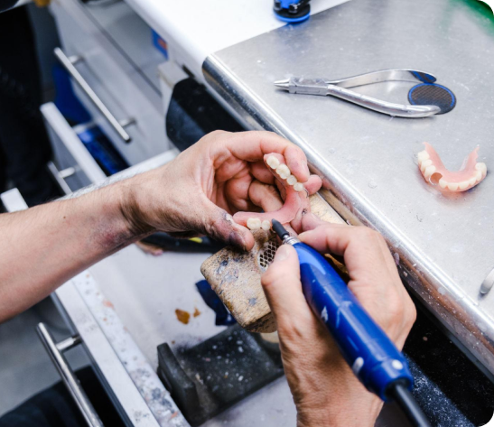Technician performing a same-day denture repair in the on-site laboratory